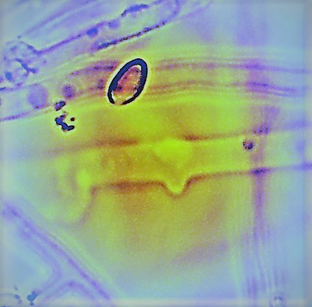 Hyphes de Mérule avec spores